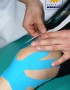 Kinesio taping - plastrowanie dynamiczne