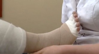Kompleksowa Terapia Obrzęku